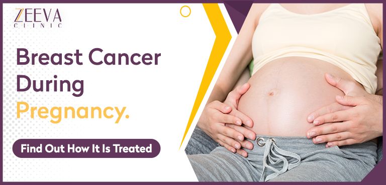 Breast Cancer During Pregnancy: Find Out How It Is Treated