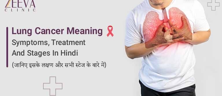 Lung Cancer Symptoms, Treatment And Stages In Hindi (जानिए इसके लक्षण और सभी स्टेज के बारे में)