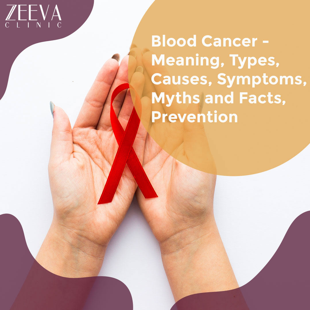 Blood Cancer – Meaning, Types, Causes, Symptoms, Myths and Facts, Prevention