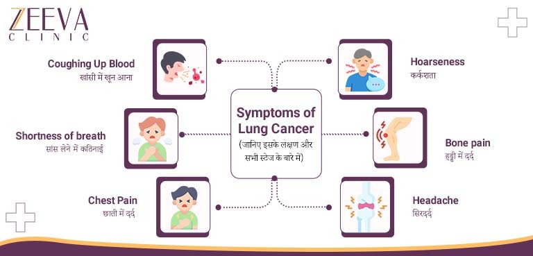Symptoms of Lung Cancer (फेफड़ों के कैंसर के लक्षण)