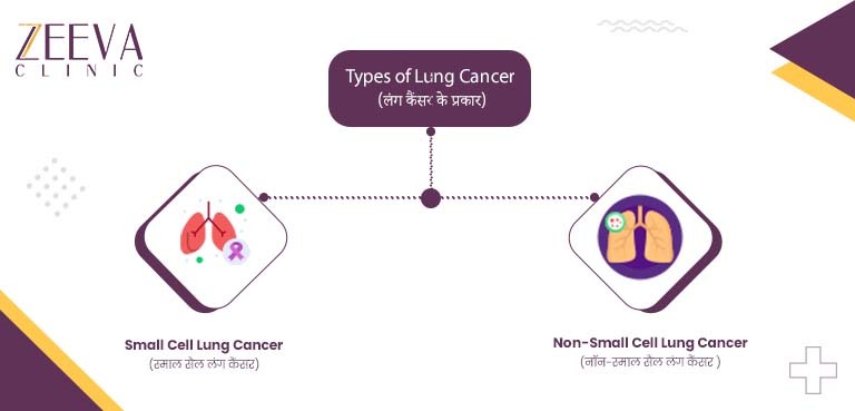 Types of Lung Cancer (लंग कैंसर के प्रकार)