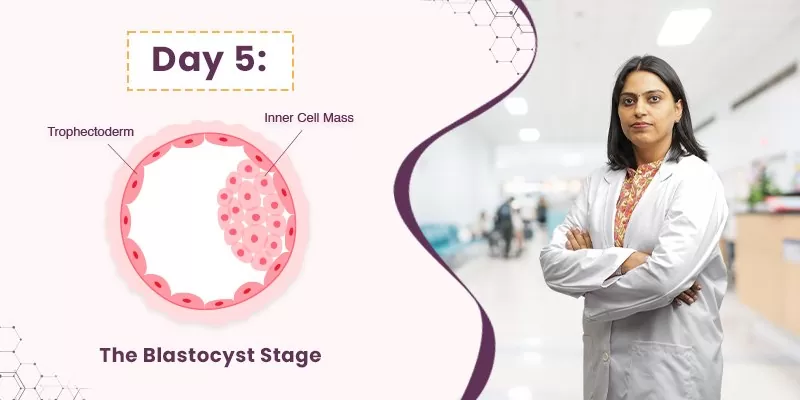 The Blastocyst Stage IVF Embryo Development day 5